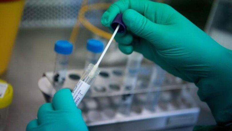 Aşı olmayan PCR testi yaptıracak